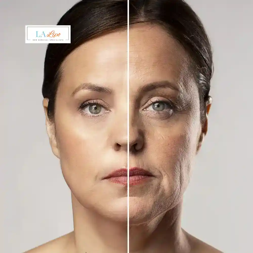 How Can You Tell If Non-Surgical Skin Tightening Is Right for You Chadwell Heath?