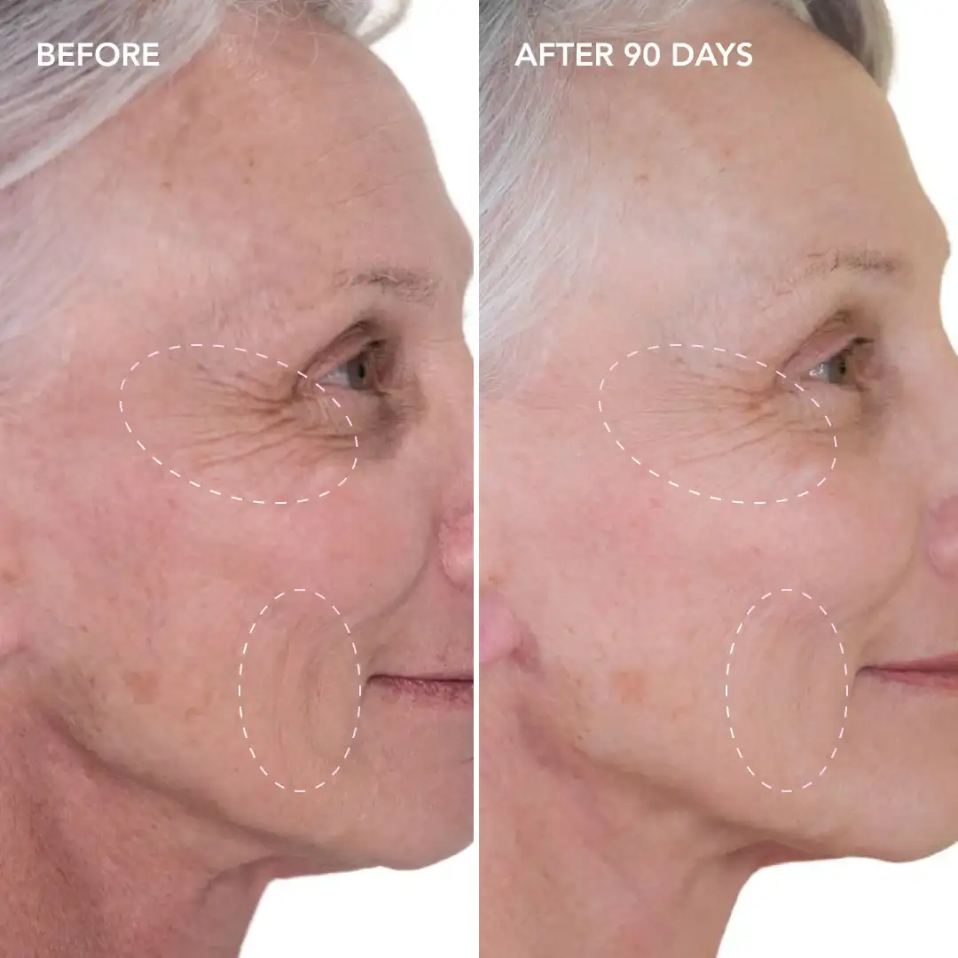 When will you see results Chadwell Heath
